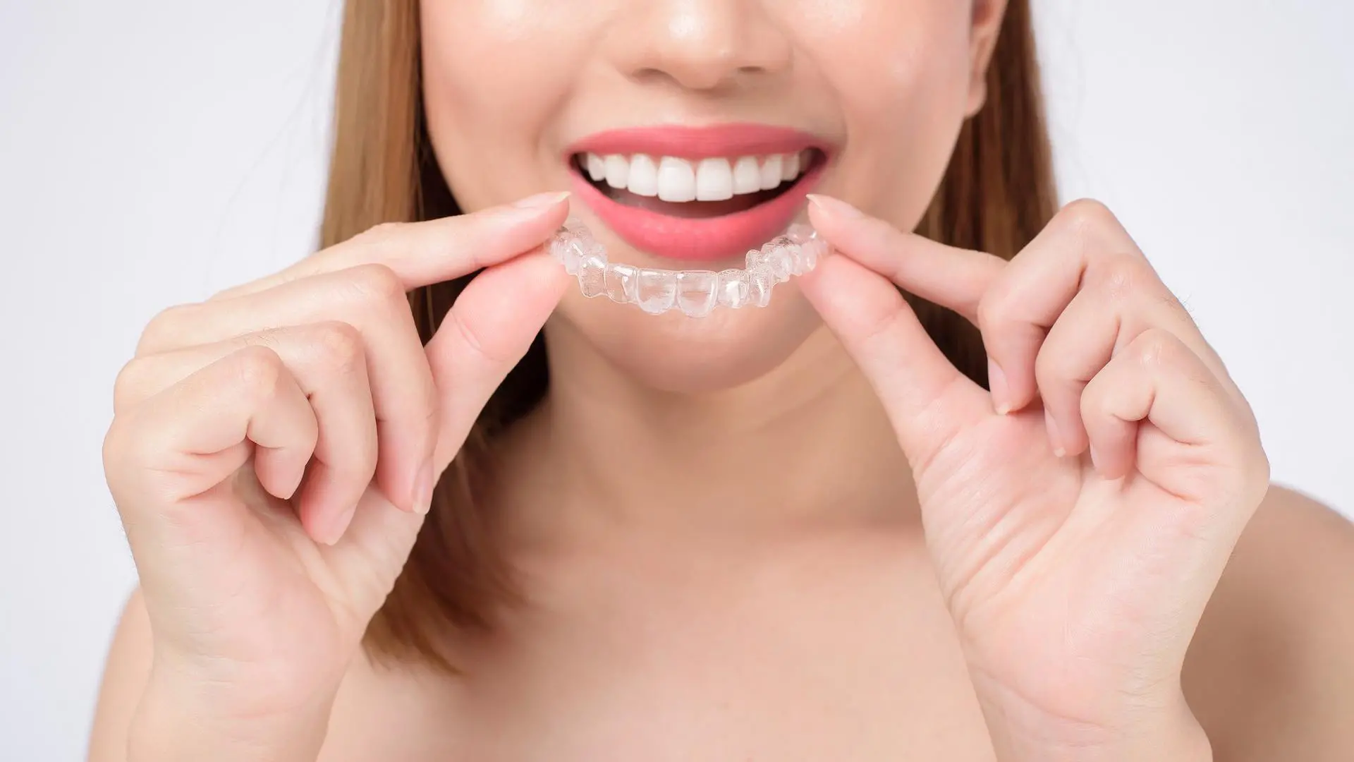 invisalign